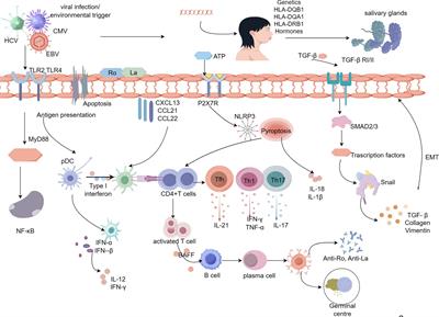 Advances in cellular and molecular pathways of salivary gland damage in Sjögren’s syndrome